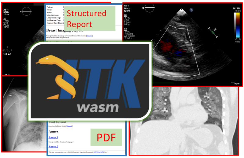 Reading DICOM images, and non-image SOP classes in JavaScript and Python