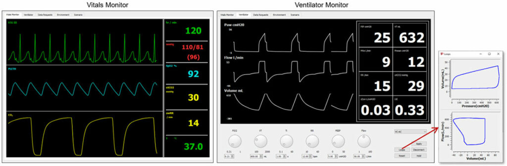 The Pulse Explorer is used to test and demonstrate training scenarios interactively with a virtual mechanical ventilator.
