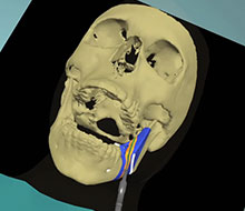 Visualization of a Skull