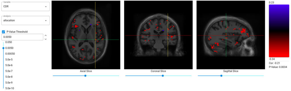 Browsing results of an OTM analysis using the vtk.js viewer.