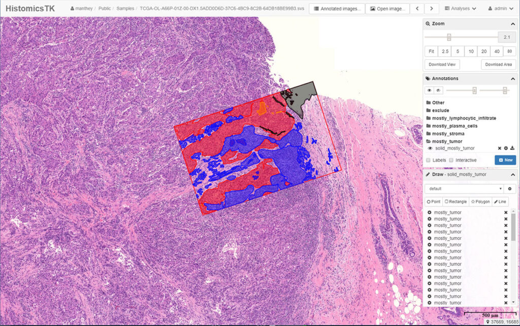 HistomicsTK allows researchers to easily create annotations and view millions of annotations simultaneously.