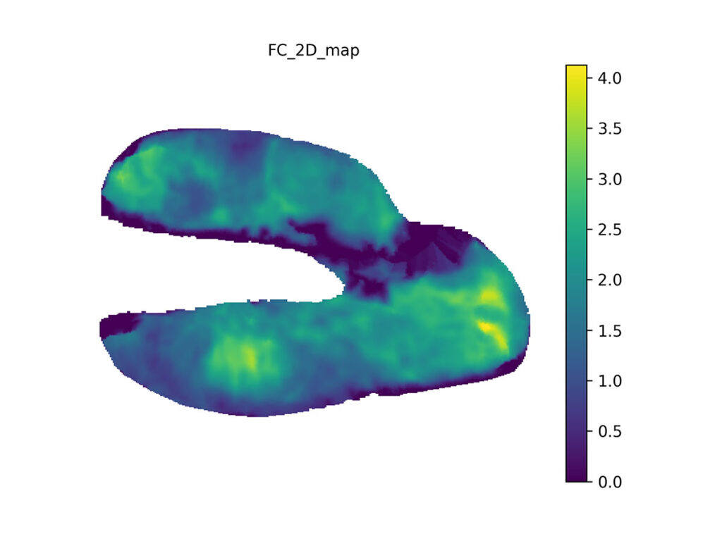 We use pre-computed mapping from canonical mesh to 2D to make analysis and comparisons easier. Cartilage thicknesses are measured in millimeters (scale bar), with the thickest part here being slightly over 4 mm thick.