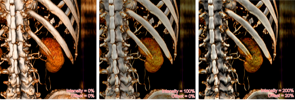 Shadow of the rib cast on the kidney behind it.
Left - no shadows. | Center - default shadows (100%/0%). | Right - strong shadows (200%/20%)