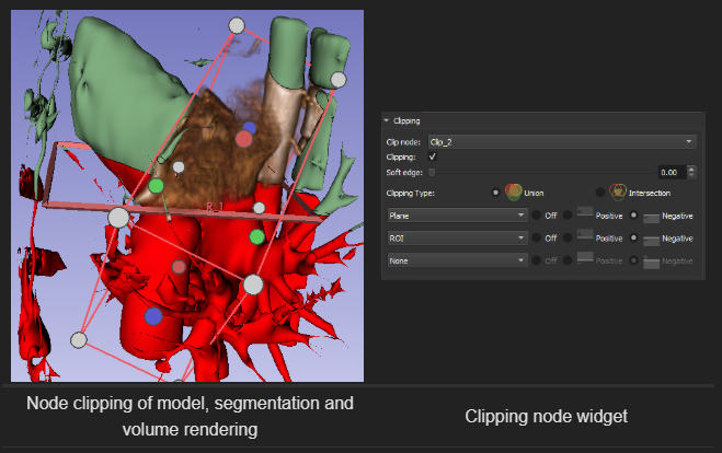 Node clipping of model, segmentation and volume rendering. And a screenshot of the clipping node widget.