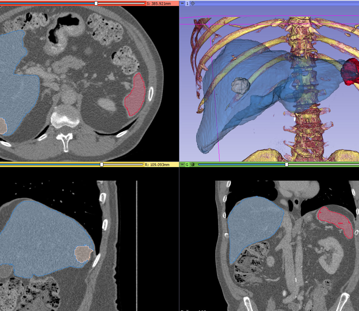 Screenshots of visualizations of a head and chest